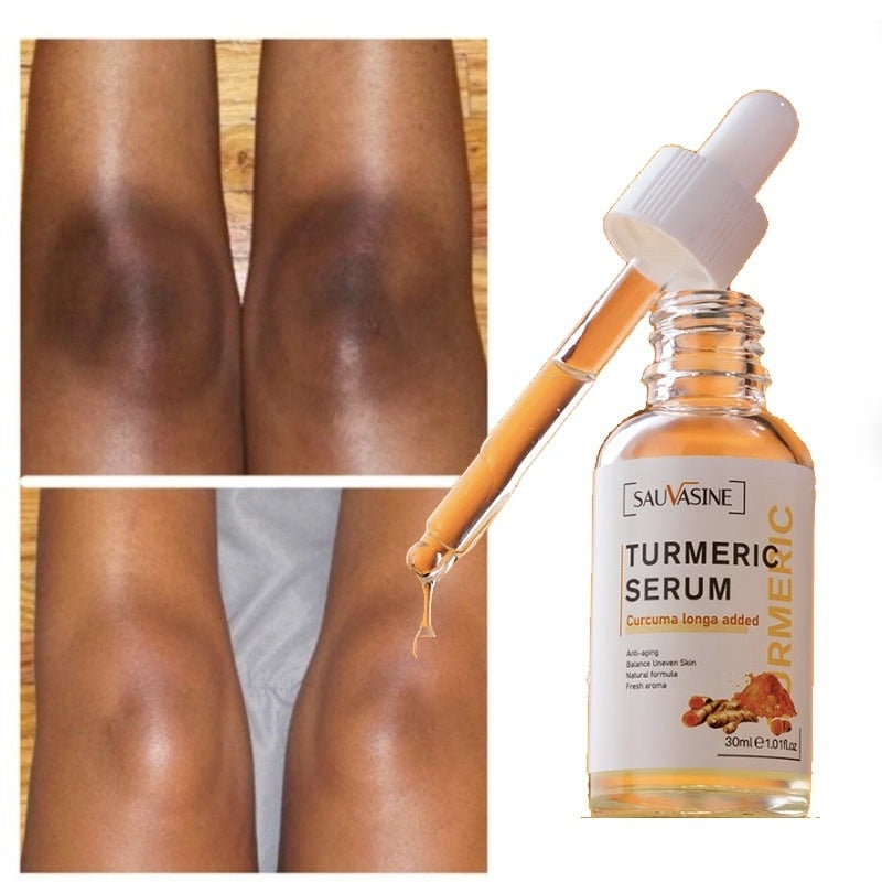 Turmeric Serum for Dark Knee lightening