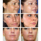 Whitening Facial Freckle Cream