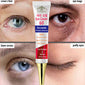 Instant Eye Cream Retinol Firming